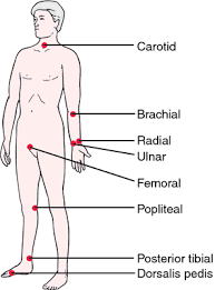 case study on low blood pressure