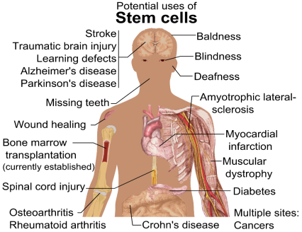 https://upload.wikimedia.org/wikipedia/commons/0/09/Stem_cell_treatments.png