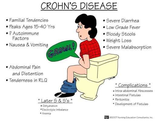 Crohn's Disease - Symptoms and Causes