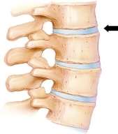 Image result for cartilaginous joints spine