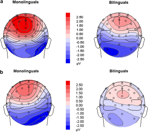 bilingual vs monolingual brain